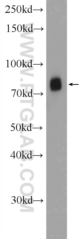 Western Blot (WB) analysis of human testis tissue using PIWIL1 Polyclonal antibody (15659-1-AP)