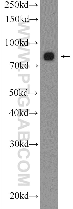 WB analysis of mouse testis using 15659-1-AP