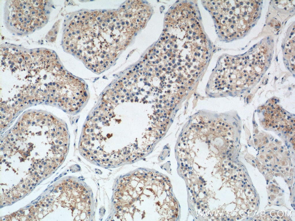 Immunohistochemistry (IHC) staining of human testis tissue using PIWIL2 Polyclonal antibody (14209-1-AP)