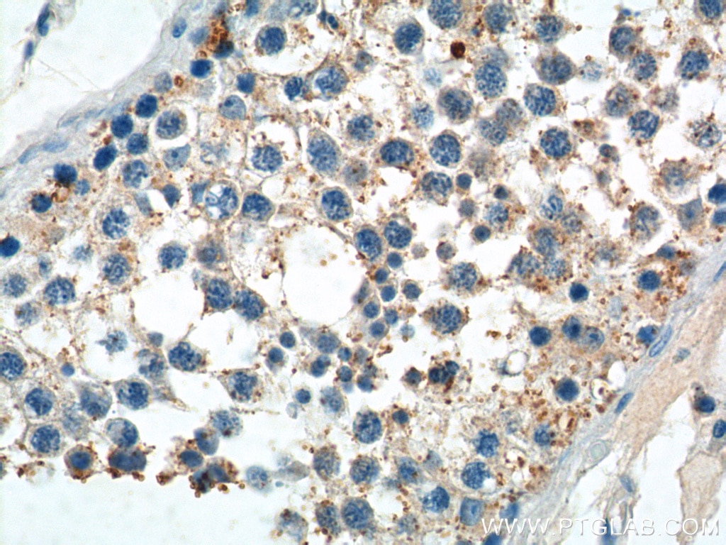 Immunohistochemistry (IHC) staining of human testis tissue using PIWIL2 Polyclonal antibody (14209-1-AP)
