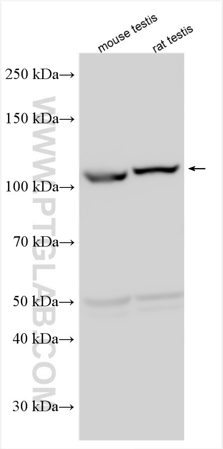 Western Blot (WB) analysis of various lysates using PIWIL2 Polyclonal antibody (34244-1-AP)