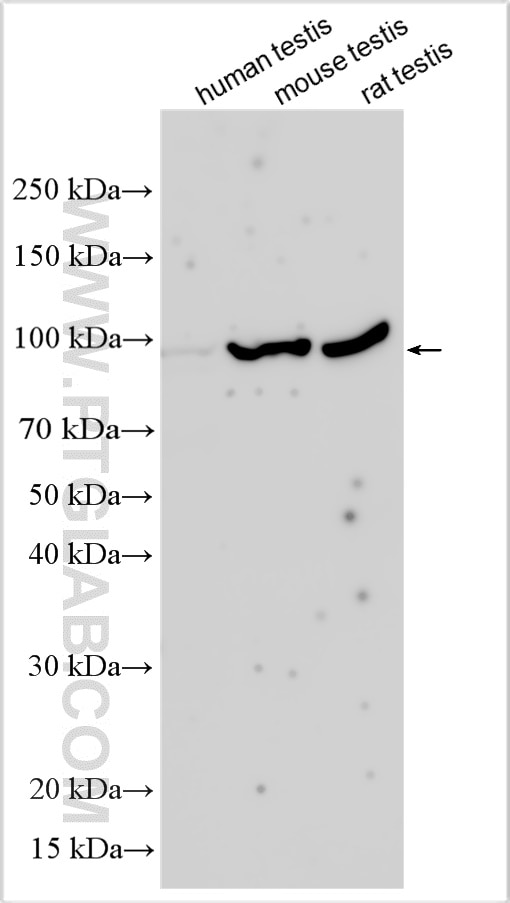 Western Blot (WB) analysis of various lysates using PIWIL4 Polyclonal antibody (12966-1-AP)