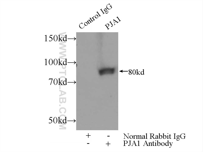 Immunoprecipitation (IP) experiment of mouse brain tissue using PJA1 Polyclonal antibody (17687-1-AP)