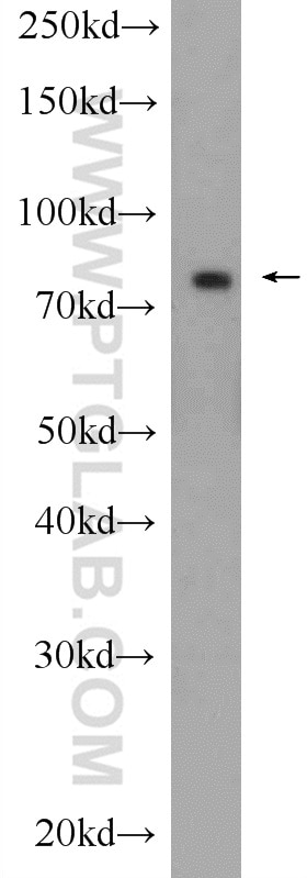 Western Blot (WB) analysis of rat brain tissue using PJA1 Polyclonal antibody (17687-1-AP)