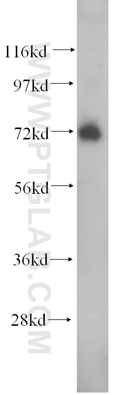 Western Blot (WB) analysis of mouse brain tissue using PJA1 Polyclonal antibody (17687-1-AP)