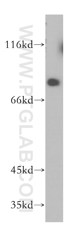 Western Blot (WB) analysis of mouse brain tissue using PJA1 Polyclonal antibody (17687-1-AP)