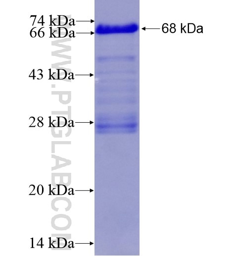 PJA1 fusion protein Ag11820 SDS-PAGE
