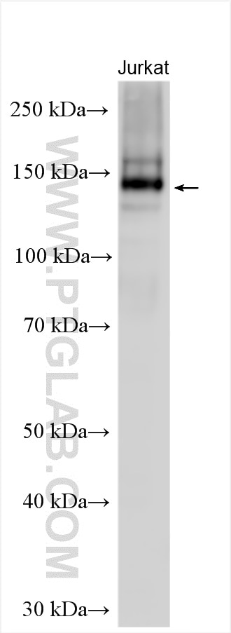 Western Blot (WB) analysis of Jurkat cells using PJA2 Polyclonal antibody (12729-1-AP)
