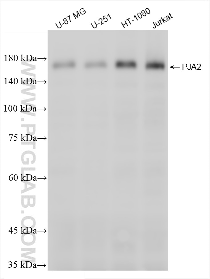 Western Blot (WB) analysis of U-87 MG cells using PJA2 Recombinant antibody (86366-2-RR)