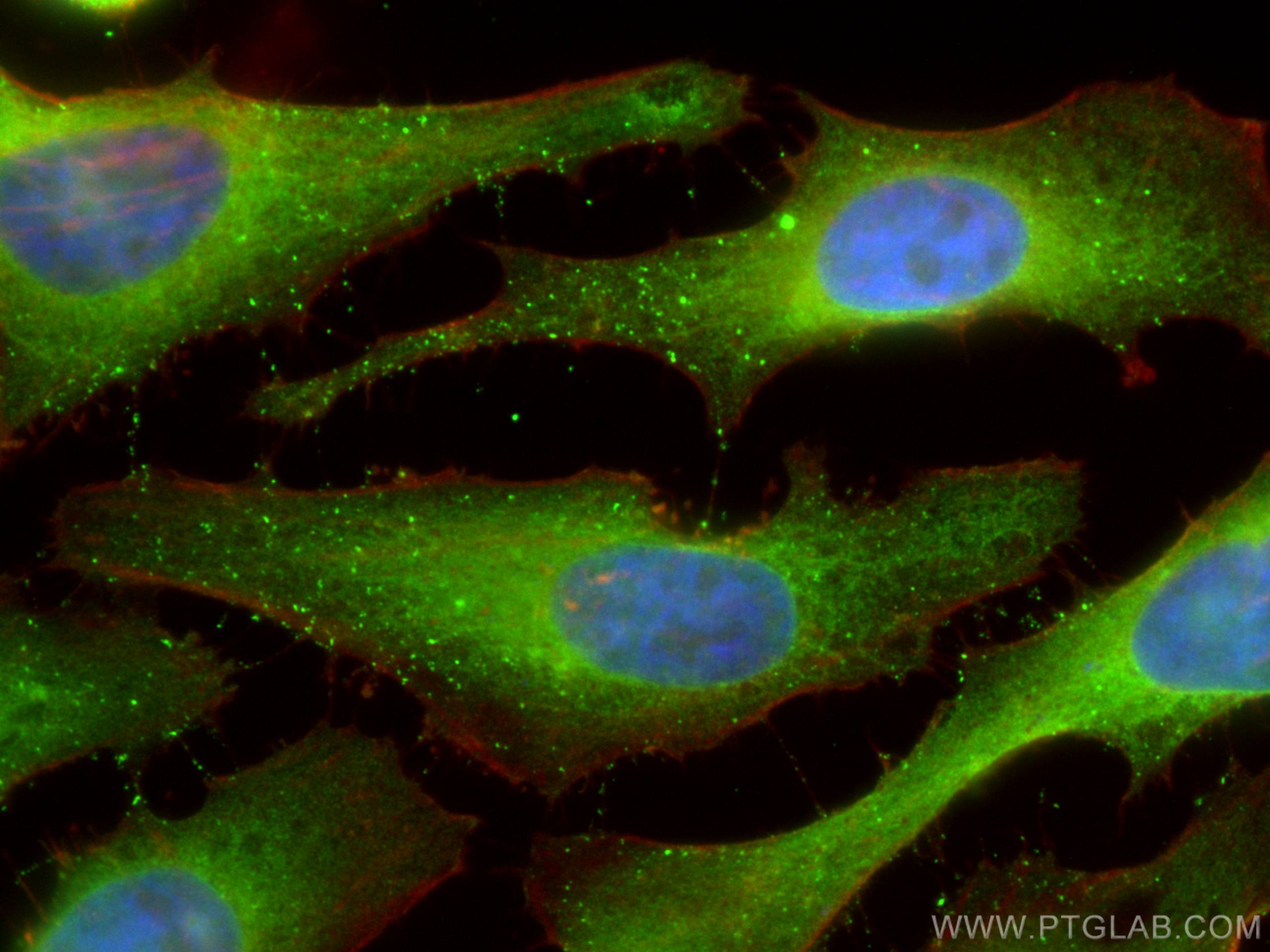 Immunofluorescence (IF) / fluorescent staining of HeLa cells using PKM2-specific Monoclonal antibody (60268-1-Ig)