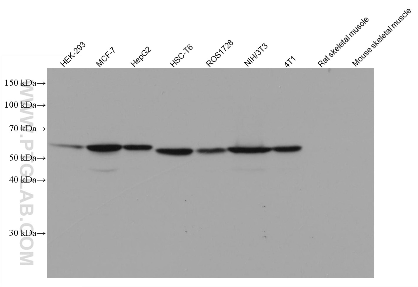 Western Blot (WB) analysis of various lysates using PKM2-specific Monoclonal antibody (60268-1-Ig)