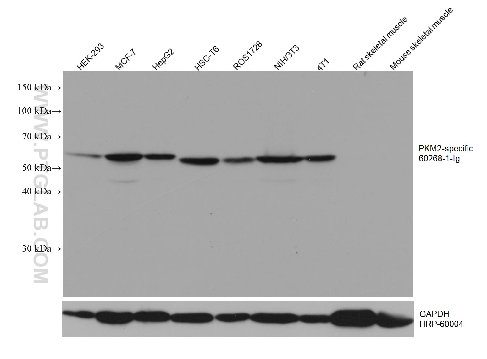 Western Blot (WB) analysis of various lysates using PKM2-specific Monoclonal antibody (60268-1-Ig)