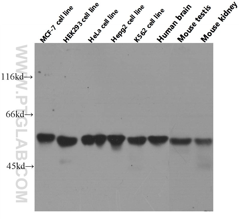 Western Blot (WB) analysis of MCF-7 cells using PKM2-specific Monoclonal antibody (60268-1-Ig)