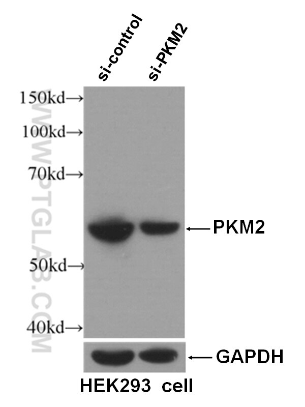 Western Blot (WB) analysis of HEK-293 cells using PKM2-specific Monoclonal antibody (60268-1-Ig)