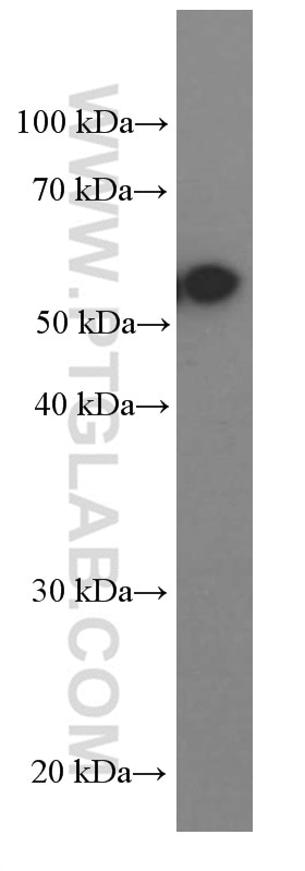 Western Blot (WB) analysis of C6 cells using PKM2-specific Monoclonal antibody (60268-1-Ig)