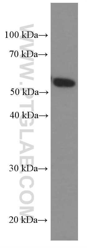 Western Blot (WB) analysis of rat brain tissue using PKM2-specific Monoclonal antibody (60268-1-Ig)