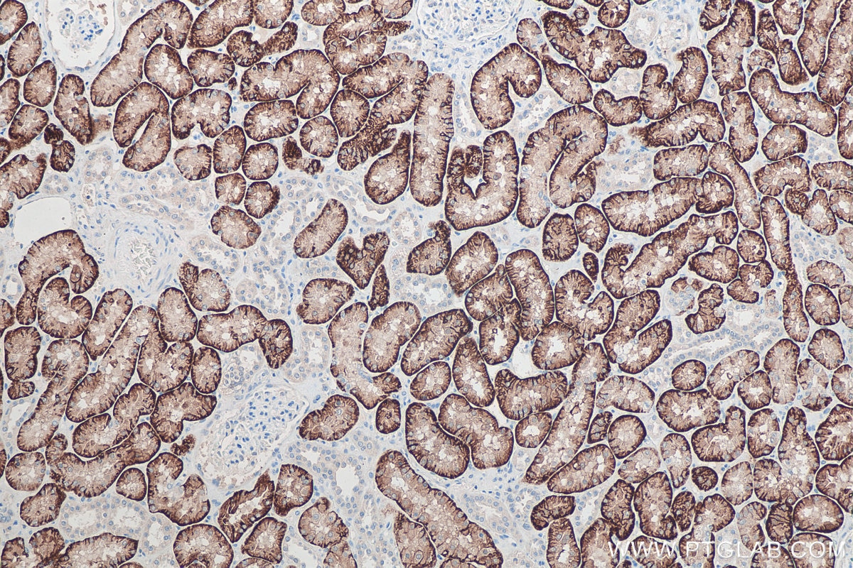 IHC analysis of human kidney tissue using Proteintech’s SLC13A3 rabbit polyclonal antibody (26184-1-AP) and IHC Prep & Detect Kit for Rabbit Primary Antibody (PK10017).