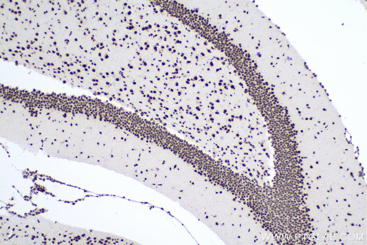 IHC analysis of mouse brain tissue using Proteintech’s TDP-43 rabbit recombinant antibody (80001-1-RR) and IHC Prep & Detect Kit for Rabbit Primary Antibody (PK10017).