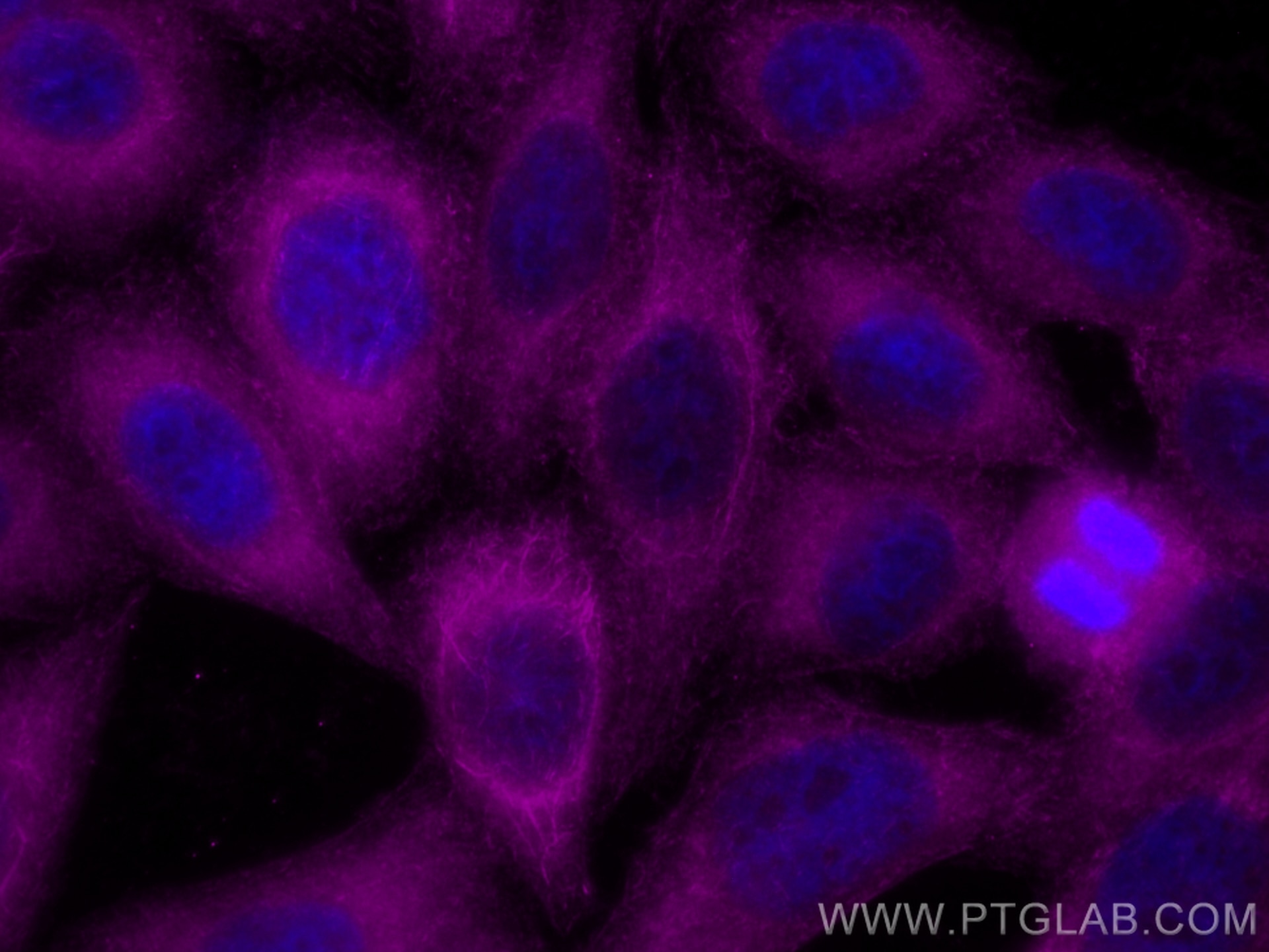Immunofluorescence (IF) / fluorescent staining of HepG2 cells using CoraLite® Plus 647-conjugated PKC Alpha Polyclonal (CL647-21991)