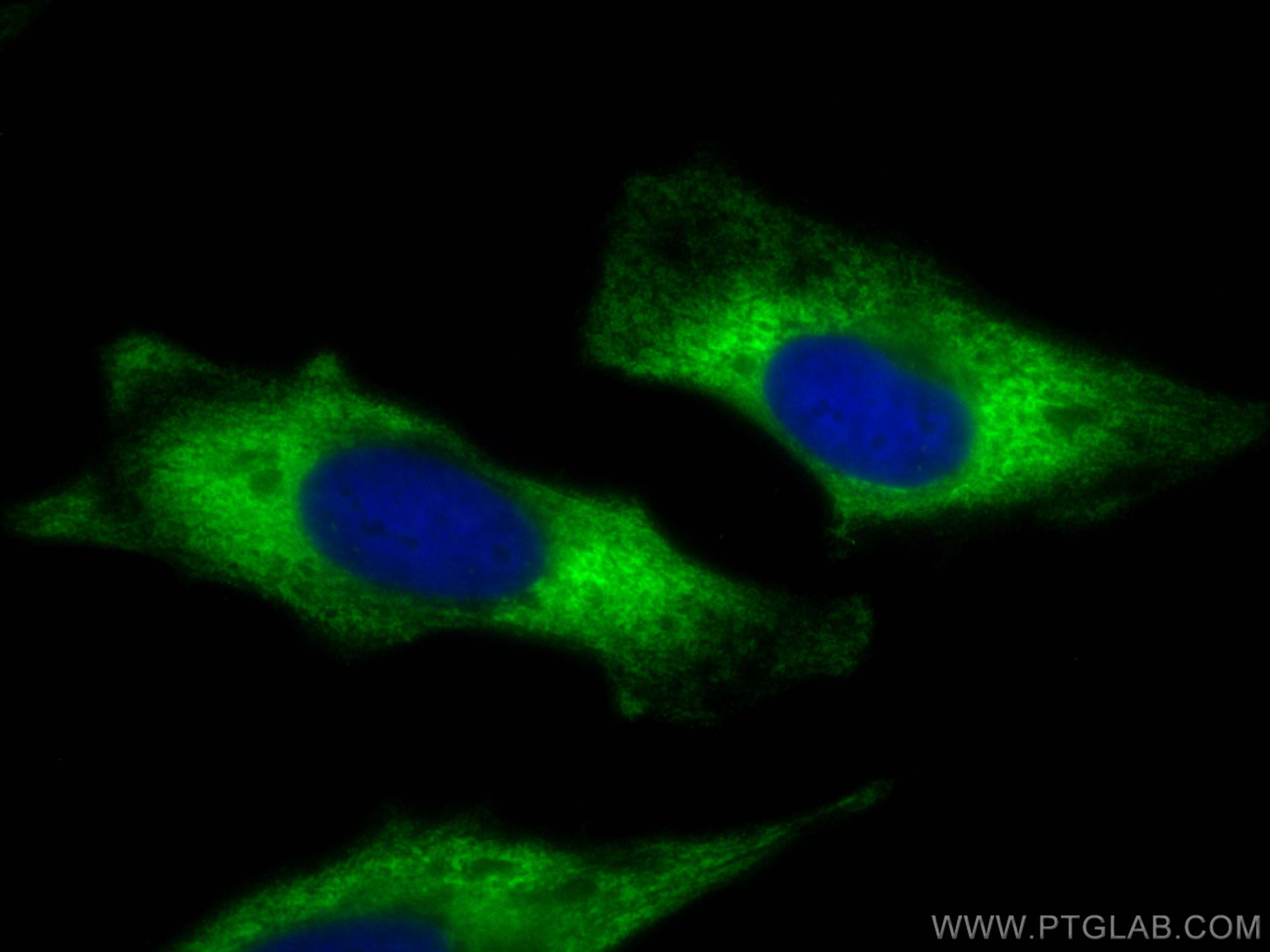 Immunofluorescence (IF) / fluorescent staining of HeLa cells using CoraLite® Plus 488-conjugated PKC Epsilon Polyclon (CL488-20877)