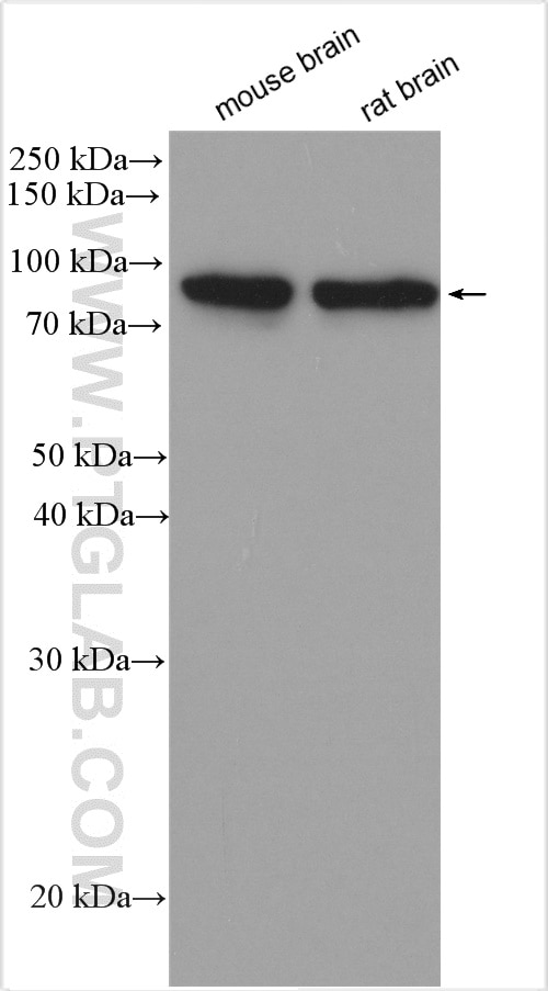 Western Blot (WB) analysis of various lysates using PKC Gamma Polyclonal antibody (29208-1-AP)