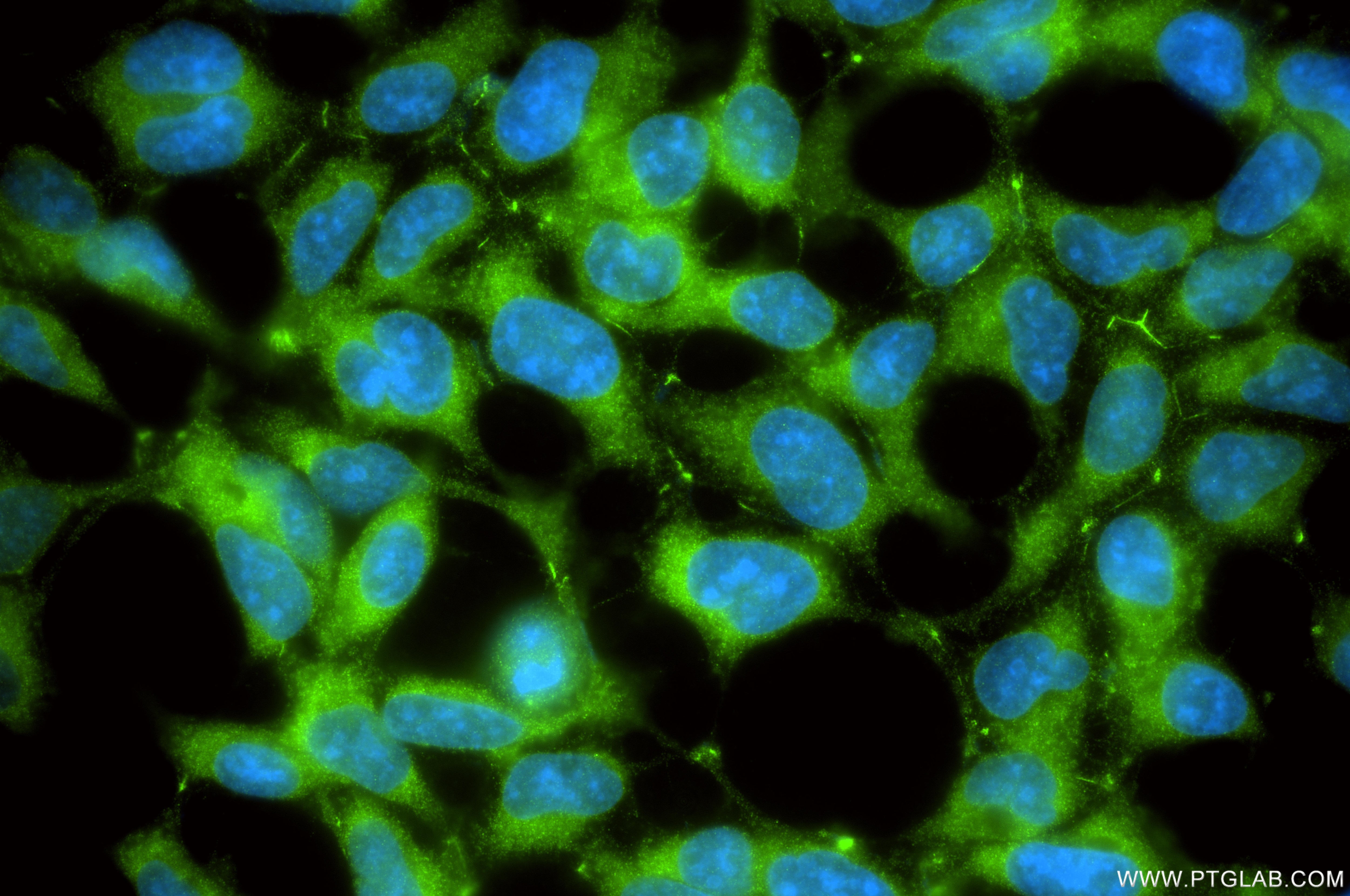 Immunofluorescence (IF) / fluorescent staining of HEK-293T cells using PKC Iota Recombinant monoclonal antibody (85733-2-RR)