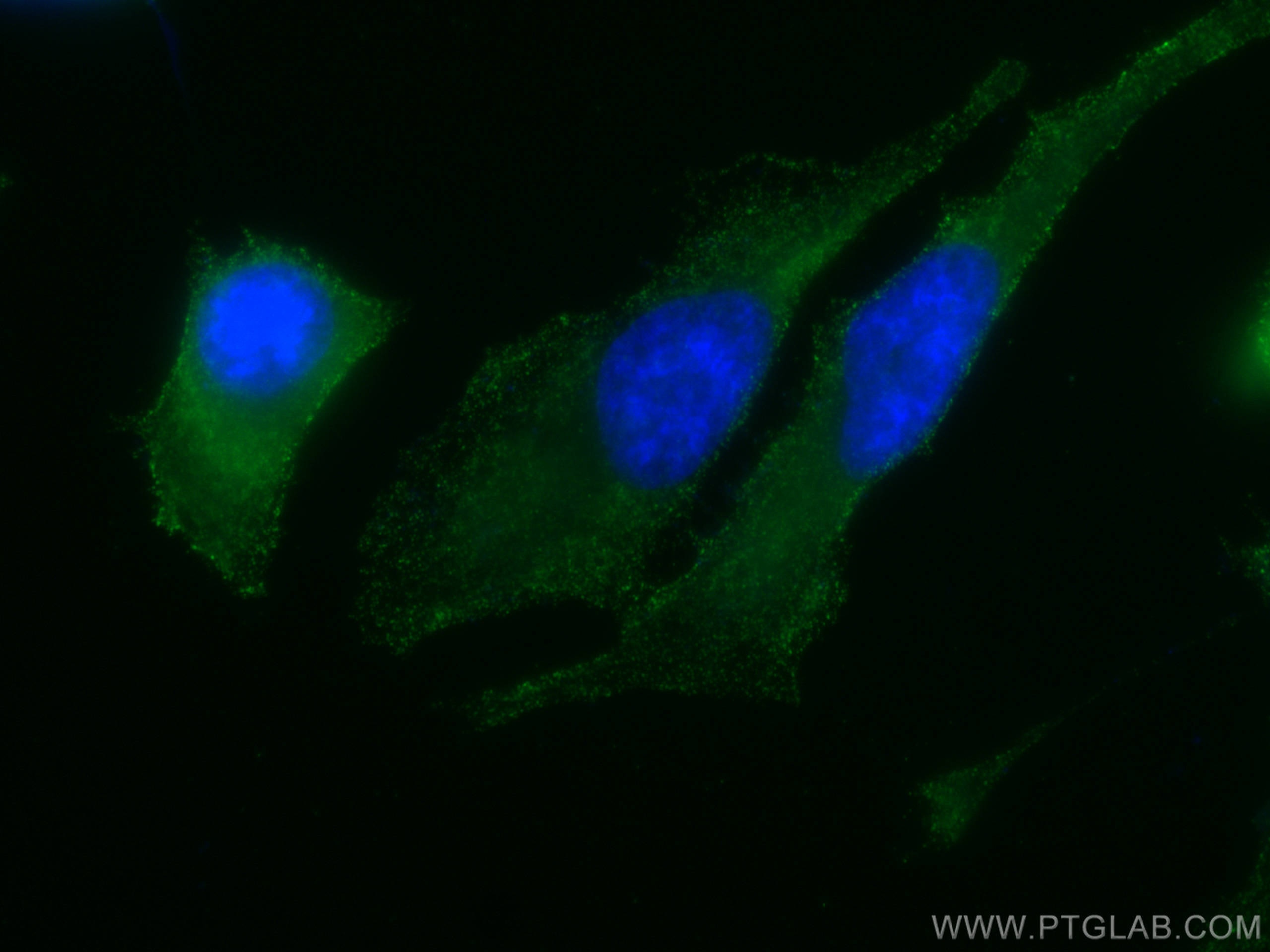Immunofluorescence (IF) / fluorescent staining of HeLa cells using PKC Alpha Monoclonal antibody (66421-1-Ig)