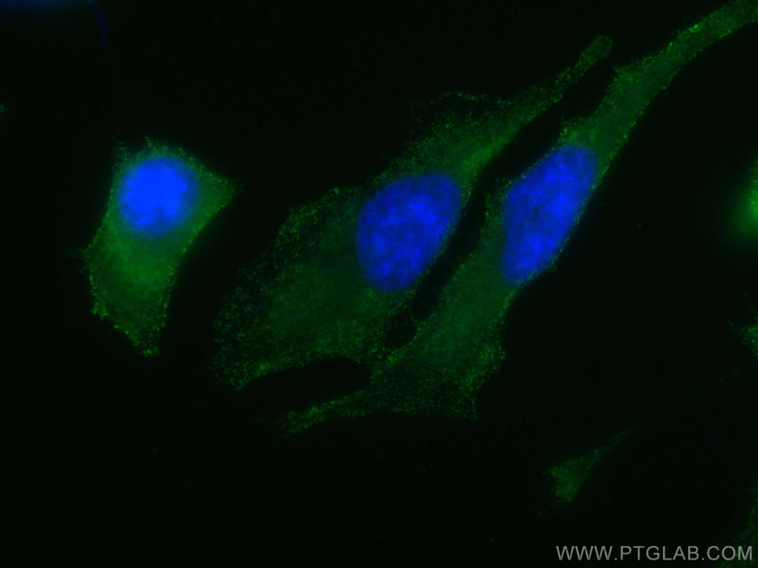 IF Staining of HeLa using 66421-1-Ig