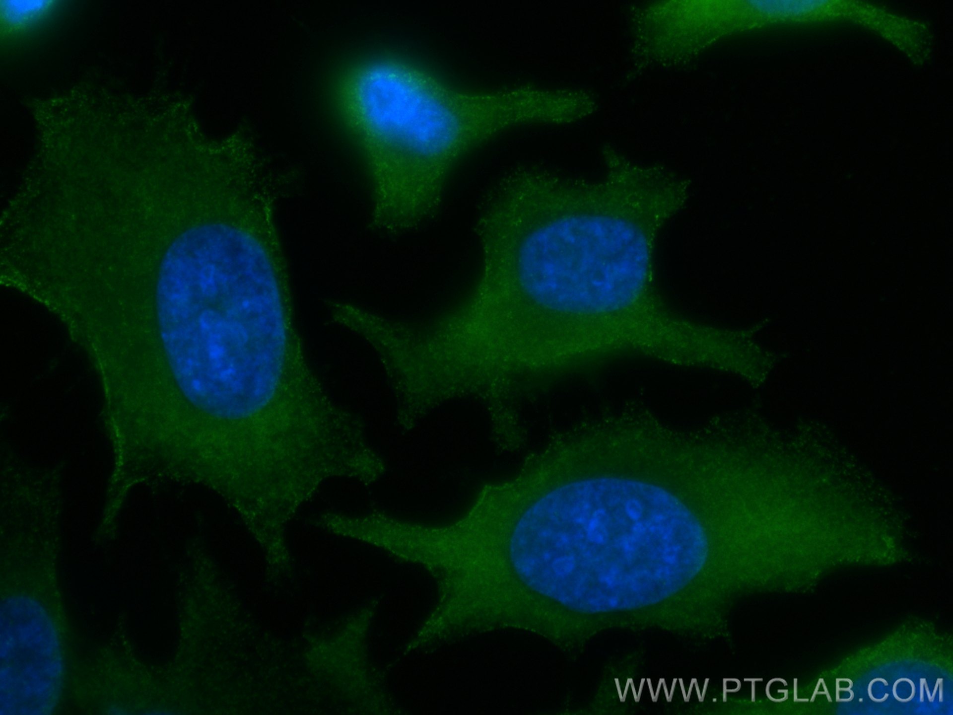 Immunofluorescence (IF) / fluorescent staining of HeLa cells using PKC Alpha Monoclonal antibody (66421-1-Ig)