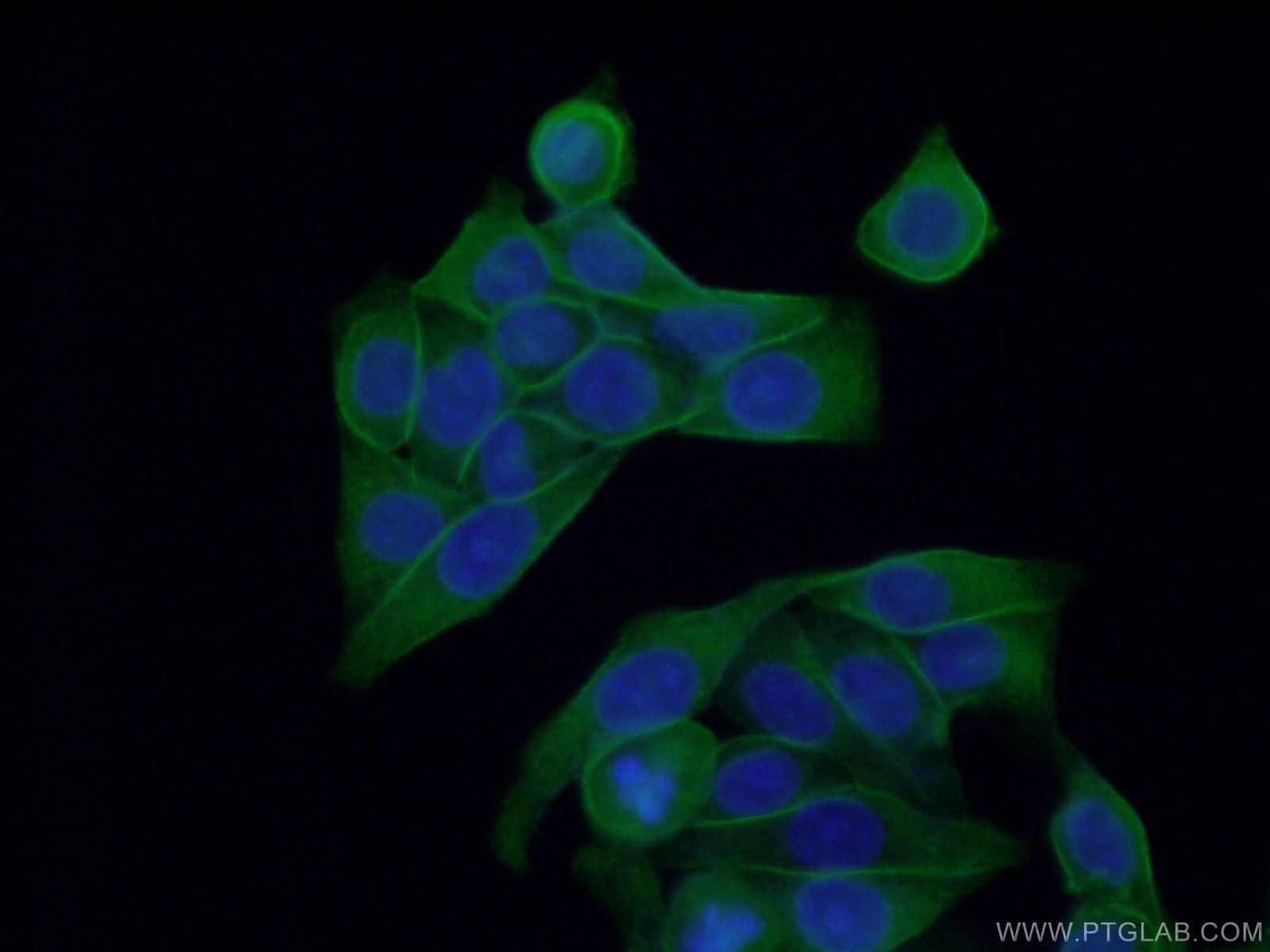 Immunofluorescence (IF) / fluorescent staining of HeLa cells using PKC Alpha Monoclonal antibody (66421-1-Ig)