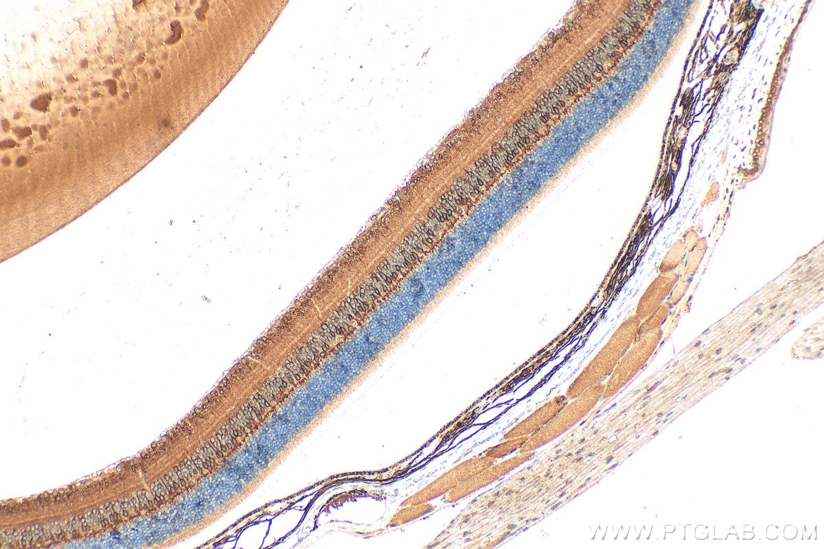 Immunohistochemistry (IHC) staining of mouse eye tissue using PKC Alpha Monoclonal antibody (66421-1-Ig)