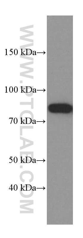 Western Blot (WB) analysis of HeLa cells using PKC Alpha Monoclonal antibody (66421-1-Ig)
