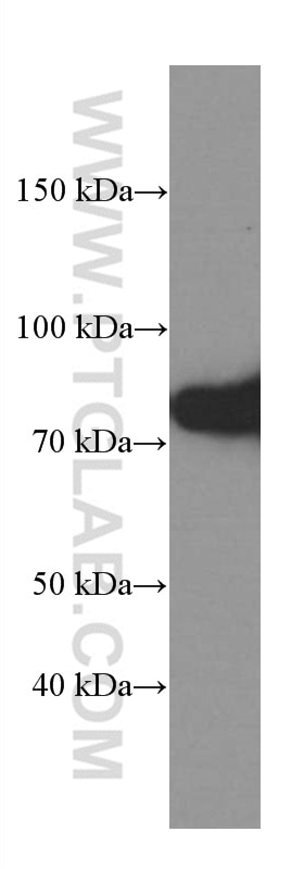 Western Blot (WB) analysis of HEK-293 cells using PKC Alpha Monoclonal antibody (66421-1-Ig)