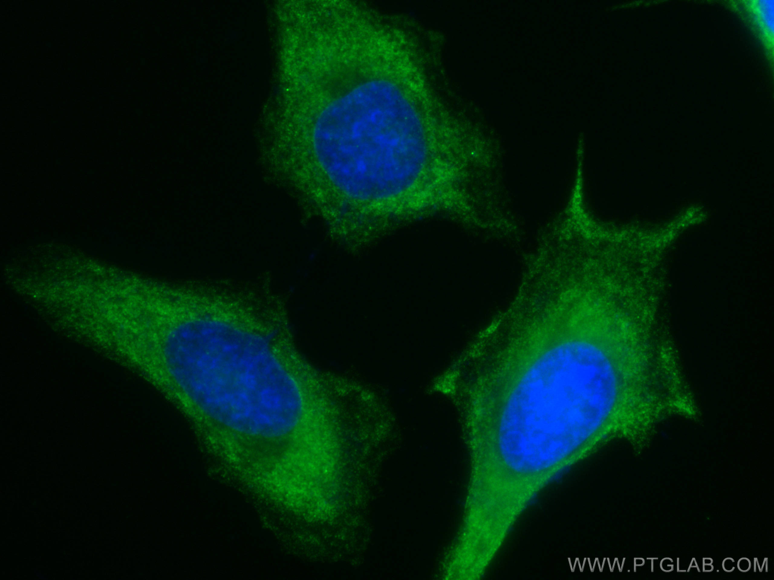 Immunofluorescence (IF) / fluorescent staining of HeLa cells using CoraLite® Plus 488-conjugated PKC Alpha Monoclonal (CL488-66421)