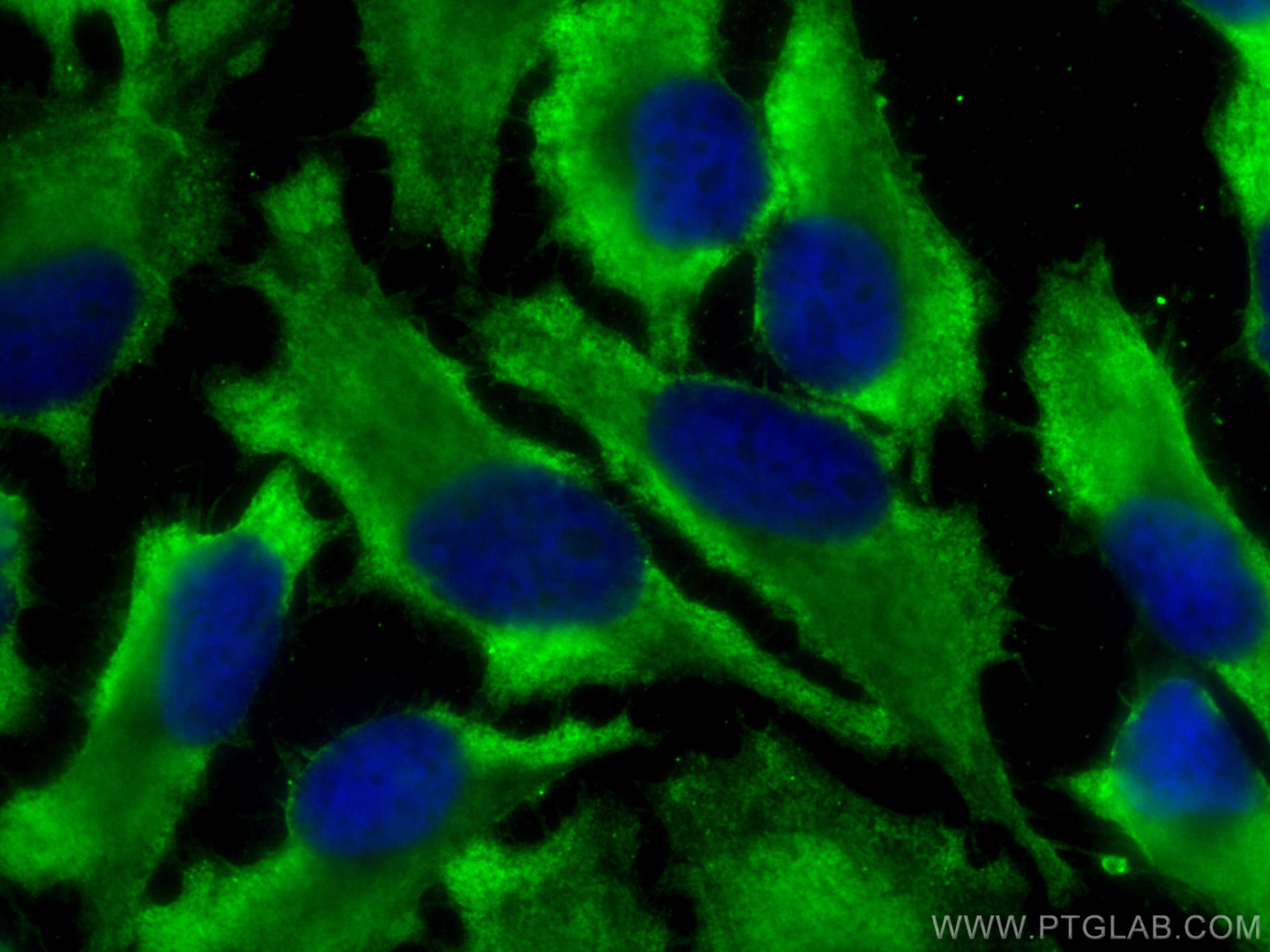 Immunofluorescence (IF) / fluorescent staining of HeLa cells using CoraLite® Plus 488-conjugated PKC Alpha Monoclonal (CL488-66421)
