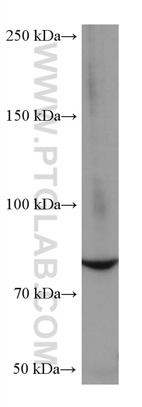 Western Blot (WB) analysis of MCF-7 cells using PKC Delta Monoclonal antibody (67113-1-Ig)