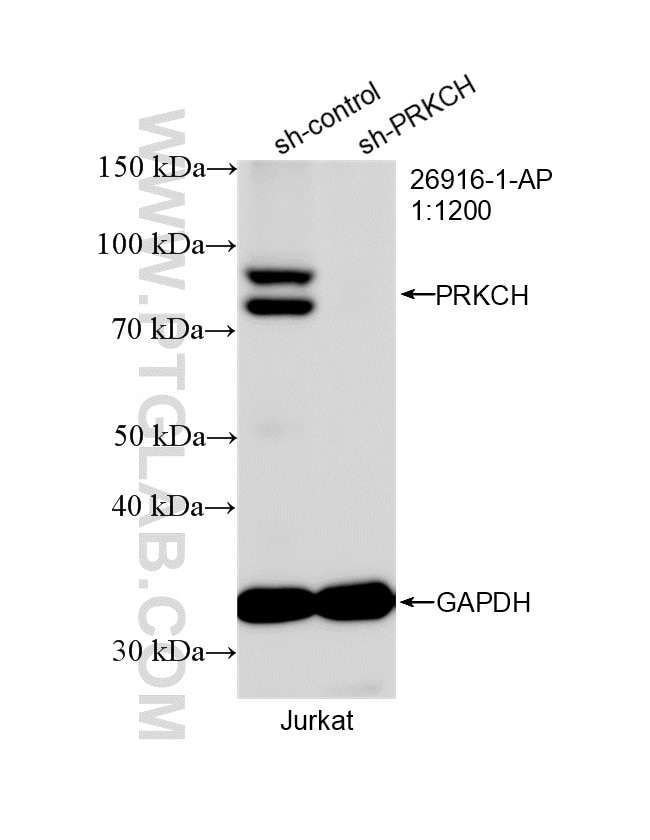 WB analysis of Jurkat using 26916-1-AP Western Blot (WB) analysis of Jurkat cells using PKC eta Polyclonal antibody (26916-1-AP)