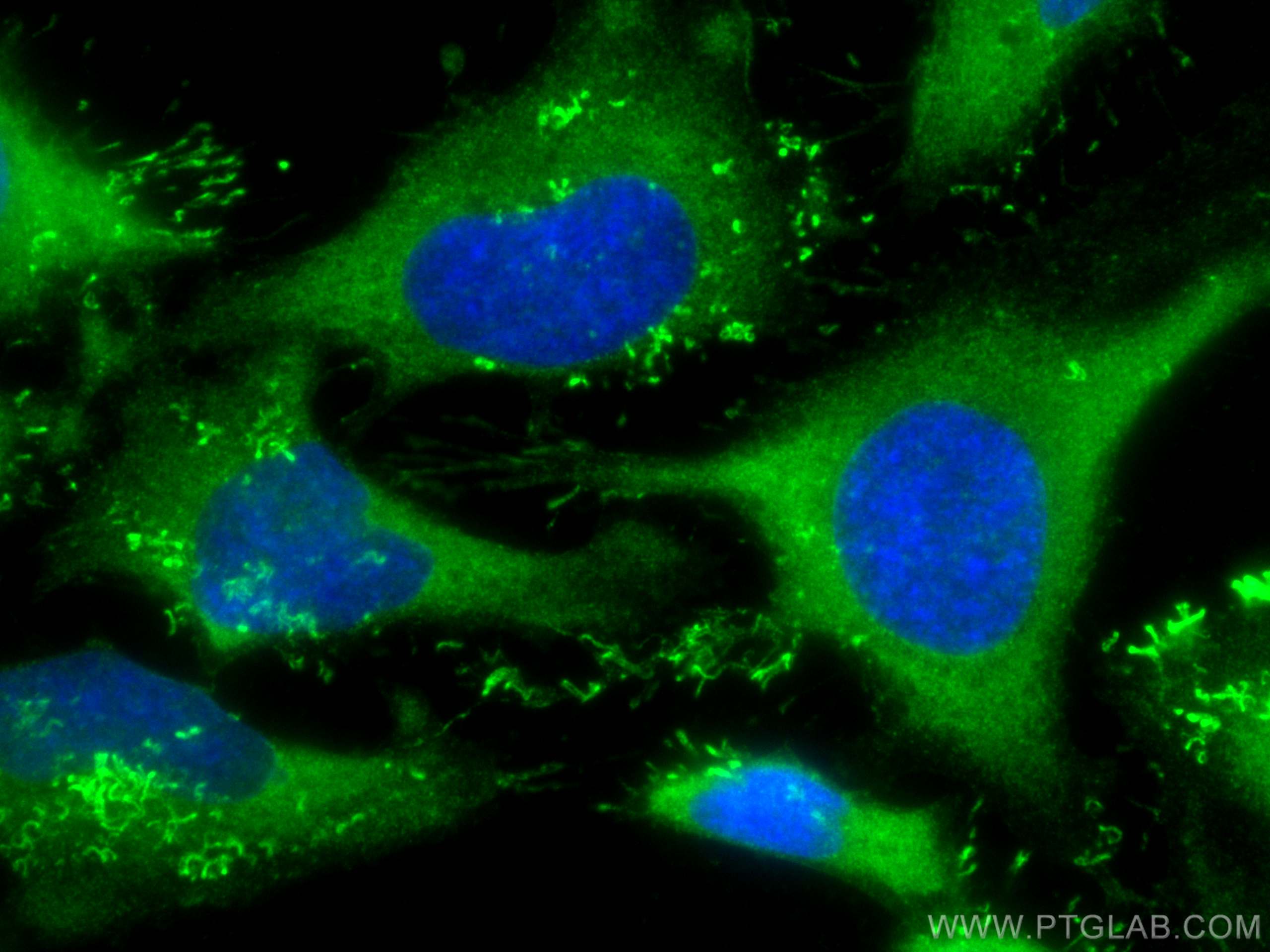 Immunofluorescence (IF) / fluorescent staining of HeLa cells using PKC Iota Monoclonal antibody (66493-1-Ig)