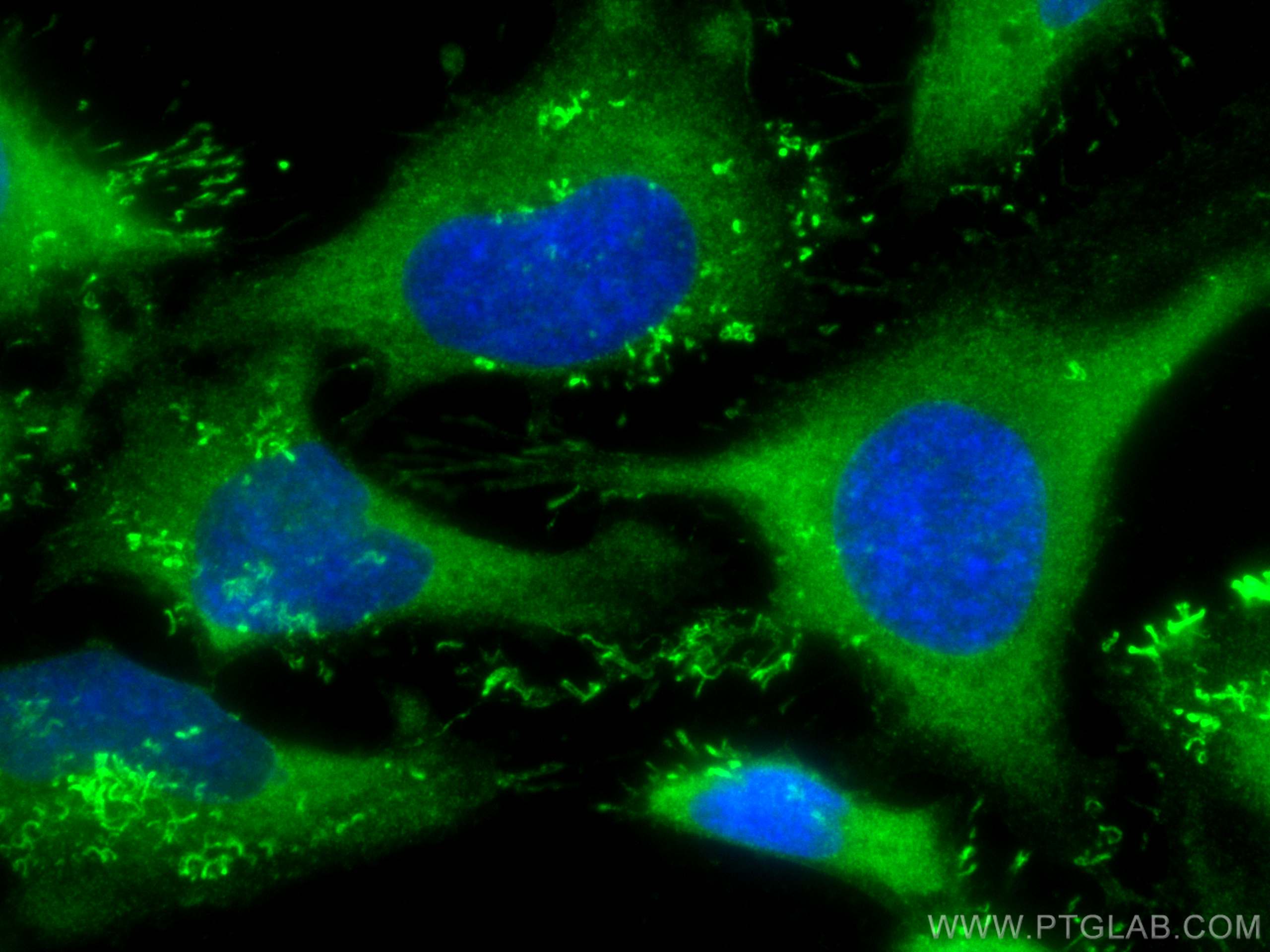 IF Staining of HeLa using 66493-1-Ig