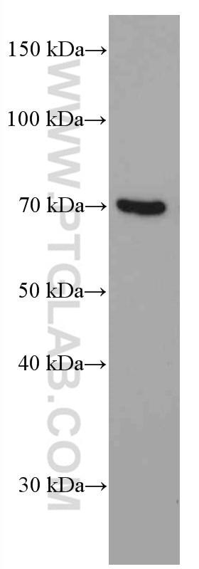 Western Blot (WB) analysis of ROS1728 cells using PKC Iota Monoclonal antibody (66493-1-Ig)