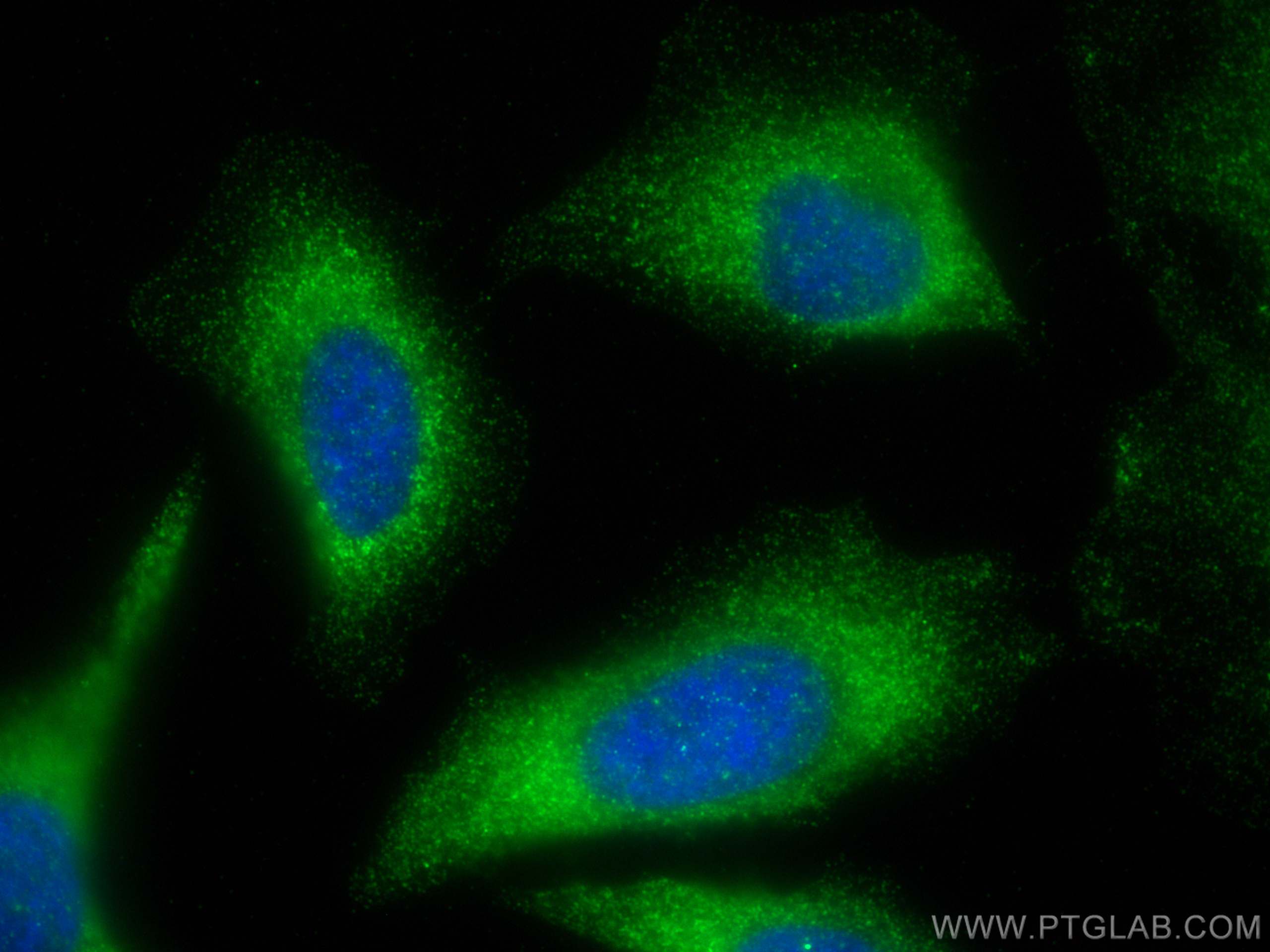 Immunofluorescence (IF) / fluorescent staining of HeLa cells using PKC Zeta Polyclonal antibody (26899-1-AP)