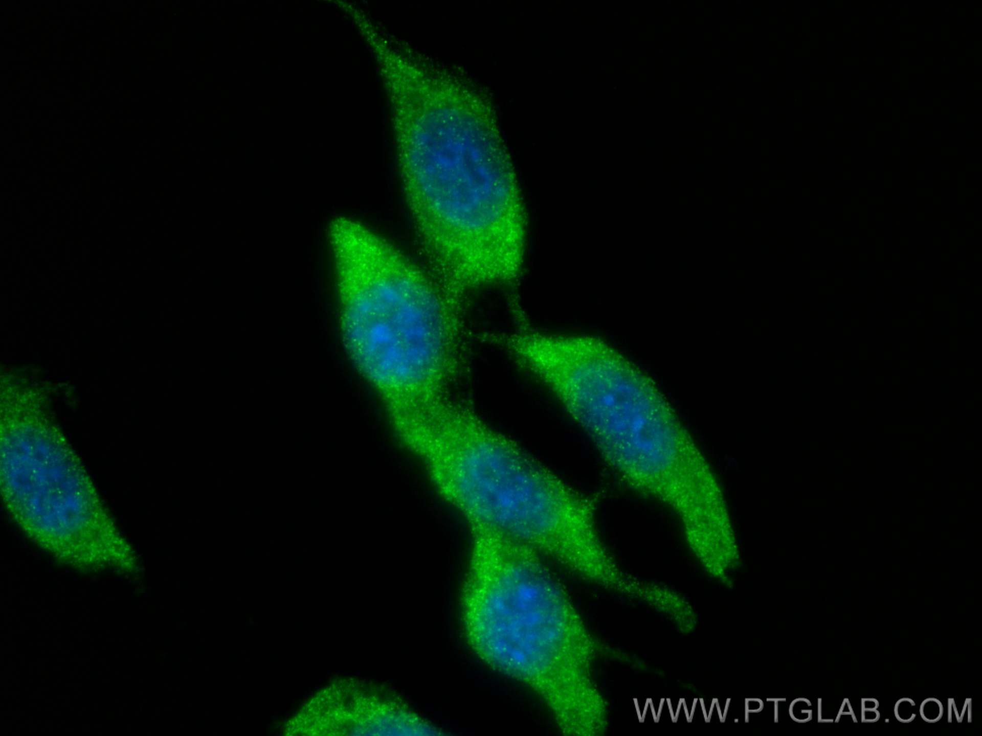 Immunofluorescence (IF) / fluorescent staining of NIH/3T3 cells using PKC Zeta Polyclonal antibody (26899-1-AP)