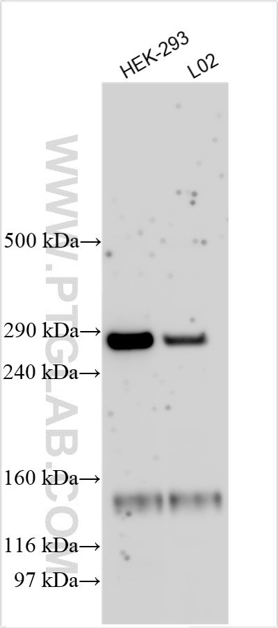 Western Blot (WB) analysis of various lysates using PKD1L2 Polyclonal antibody (16333-1-AP)