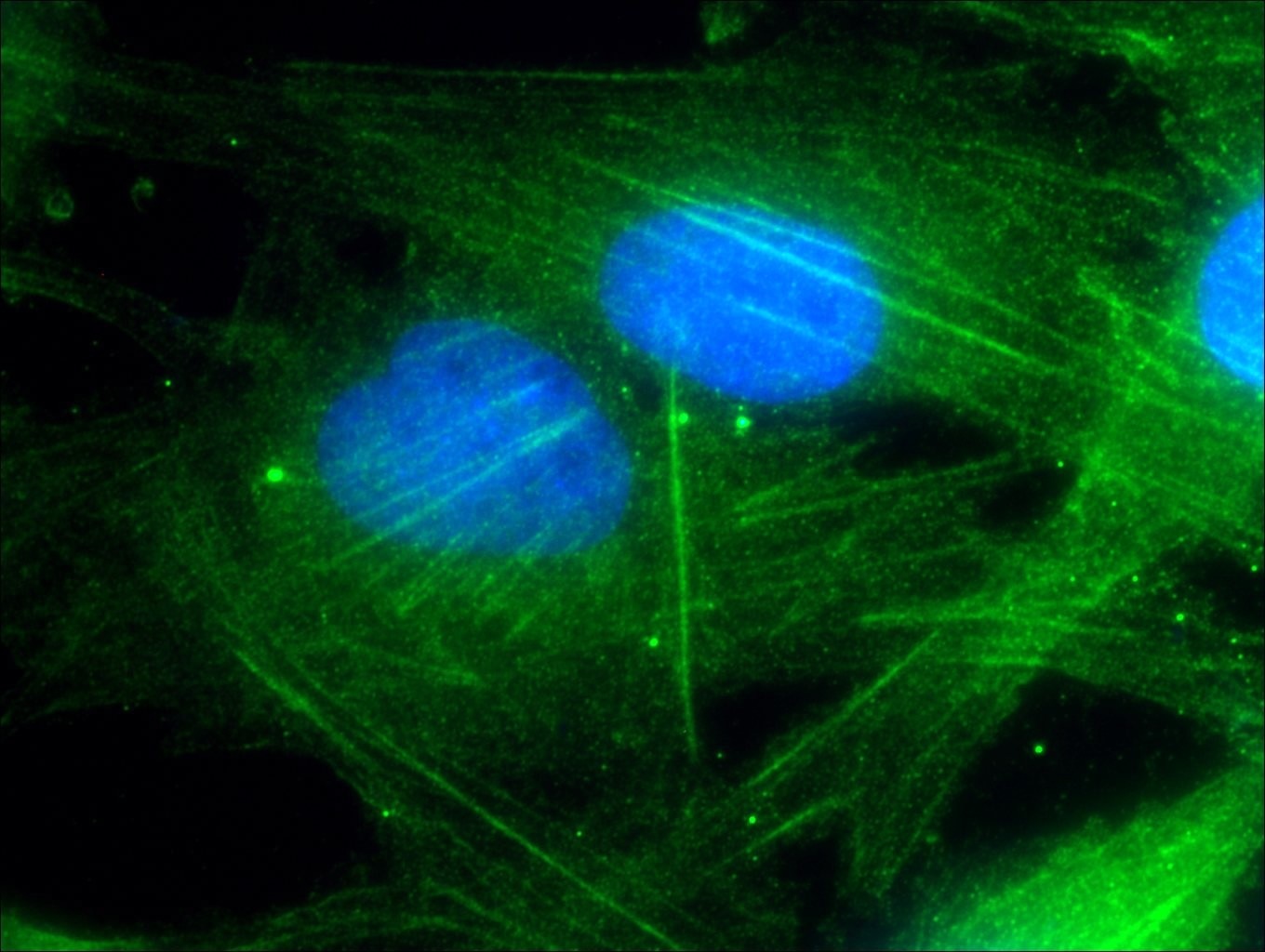 Immunofluorescence (IF) / fluorescent staining of MDCK cells using Polycystin 2 Polyclonal antibody (19126-1-AP)