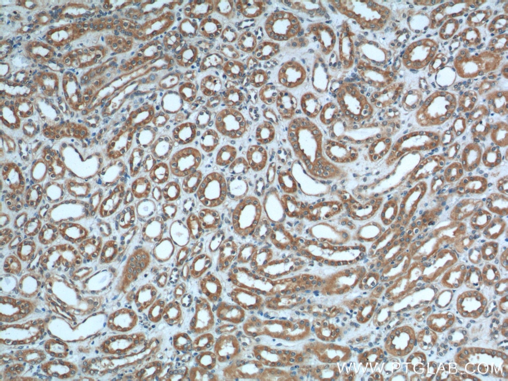 Immunohistochemistry (IHC) staining of human kidney tissue using Polycystin 2 Polyclonal antibody (19126-1-AP)