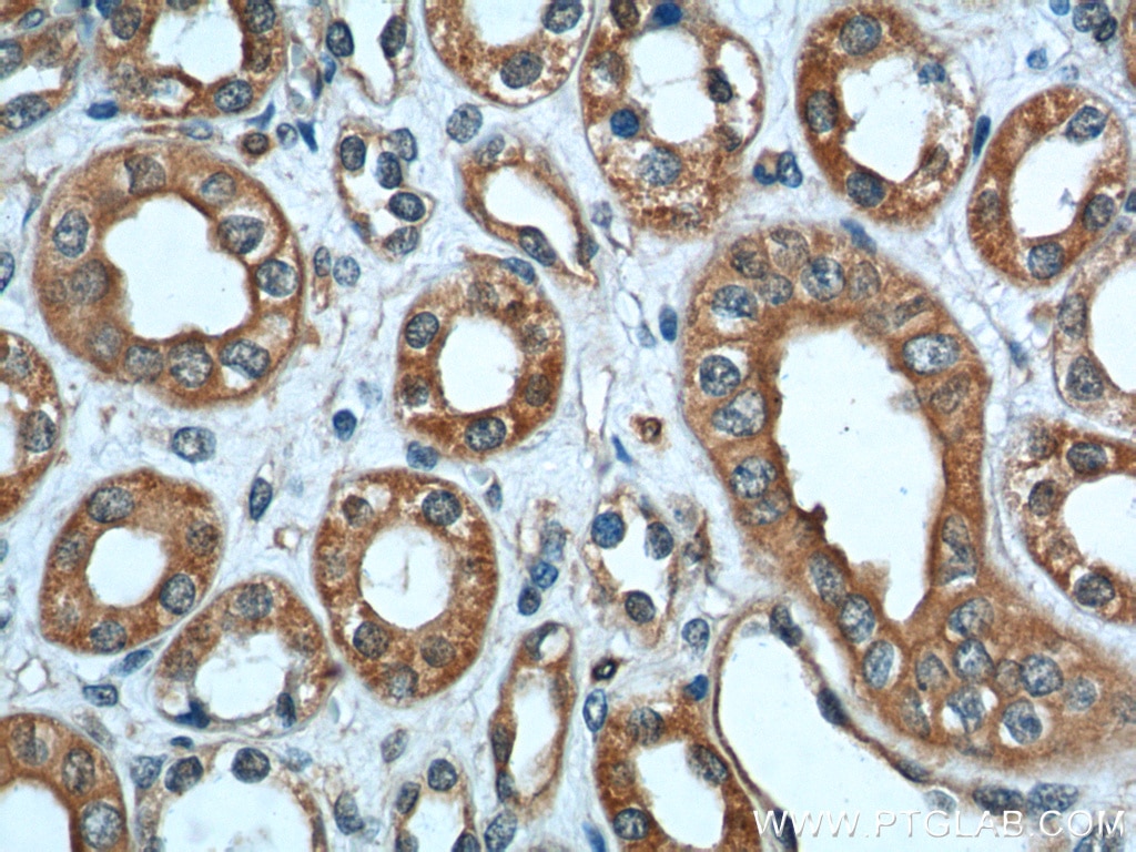 Immunohistochemistry (IHC) staining of human kidney tissue using Polycystin 2 Polyclonal antibody (19126-1-AP)