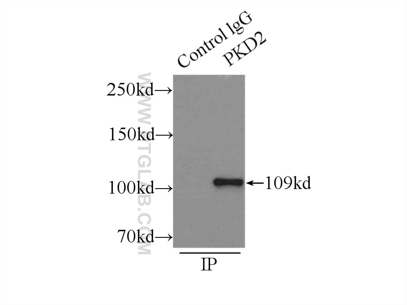 Immunoprecipitation (IP) experiment of mouse testis tissue using Polycystin 2 Polyclonal antibody (19126-1-AP)