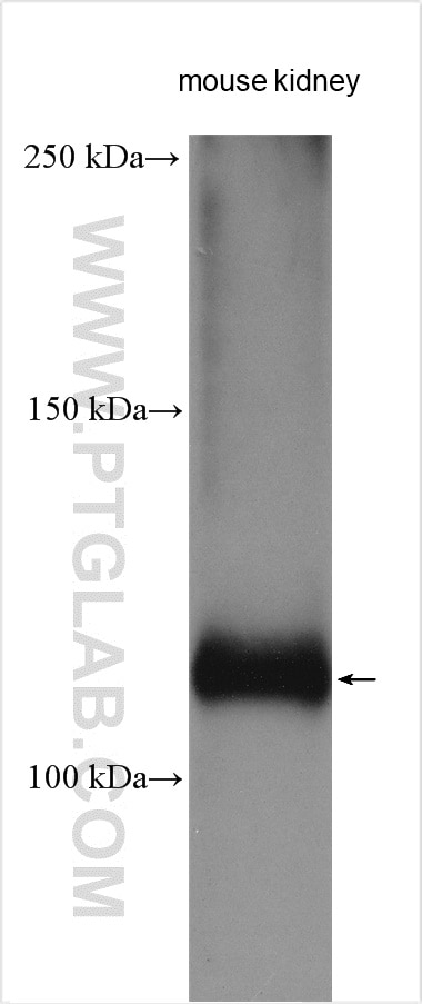 Western Blot (WB) analysis of various lysates using Polycystin 2 Polyclonal antibody (19126-1-AP)