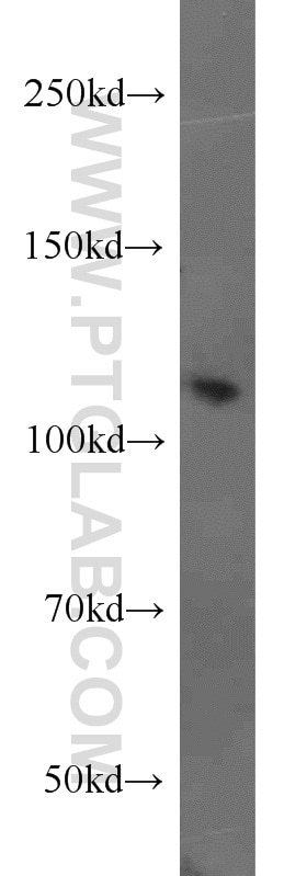 Western Blot (WB) analysis of HEK-293 cells using Polycystin 2 Polyclonal antibody (19126-1-AP)