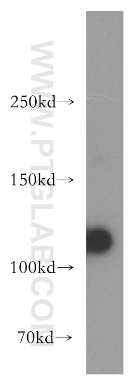 Western Blot (WB) analysis of human kidney tissue using Polycystin 2 Polyclonal antibody (19126-1-AP)